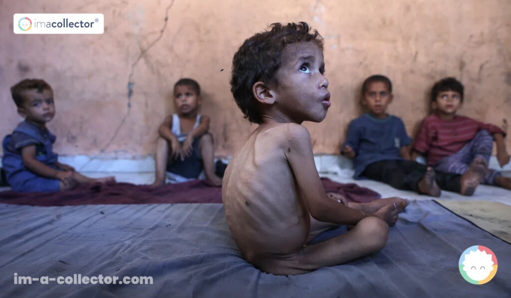 Yazan, enfant palestinien de 2 ans souffrant de malnutrition, avec ses frères dans le camp d’al-Shati à Gaza en juillet 2025.